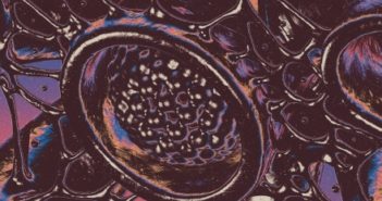 AUA – The Damaged Organ AUA – The Damaged Organ (Crazysane Records, 21.01.22)